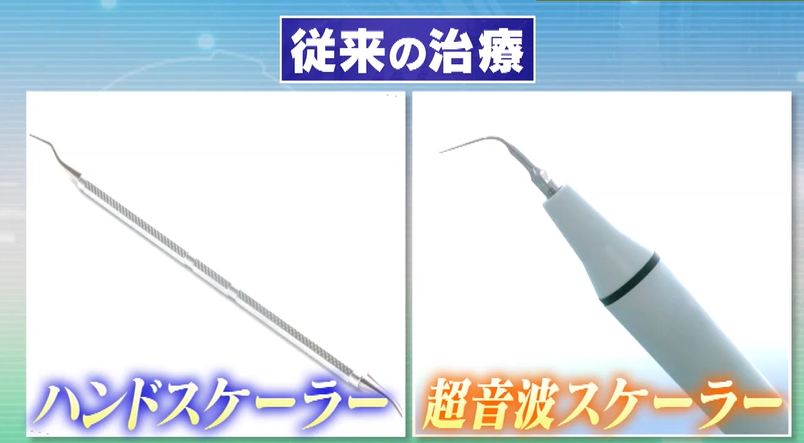 従来の治療